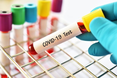 Novo tipo de reagentes de teste de diagnóstico rápido covid-19 em Cingapura